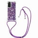 thumbnail image 1 of Funda FOXDOCK para Xiaomi Redmi Note 12s 4G con Cuerda Ajustable, Brillo Líquido, Protección Antigolpes y Lente – Ideal para Regalo, 1 of 6