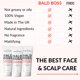 thumbnail image 4 of Hidratante para cuero cabelludo The Bald Brothers 90 ml (2 unidades), 4 of 6