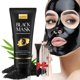 thumbnail image 1 of Mascarilla YLNALO de carbón para puntos negros, kit de 3,5 oz (104 ml), 1 of 3