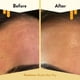 thumbnail image 4 of Limpiador facial ECZEMA HONEY Avena Previene los brotes 180 ml, 4 of 6