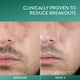 thumbnail image 3 of Limpiador Cetaphil Gentle Clear Complexion con 2,6% de BPO 125 ml, 3 of 3