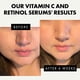 thumbnail image 3 of Set de cuidado de la piel Eclat, sérum facial, vitamina C, retinol, antienvejecimiento, 3 of 8