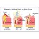 thumbnail image 2 of Jabón Joesoef Antiacné con azufre volcánico natural 10% 100 ml x3, 2 of 9