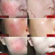 thumbnail image 3 of 7 Day Repair Facial Redness Cream Soothing Redness Repair Skin Rosacea Red Blood Improve Sensitive Skin CareKorean Cosmetic 40ml, 3 of 3