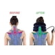 thumbnail image 3 of Dispositivo Inflable de Tracción Cervical RUNZI Azul, 3 of 8