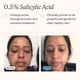 thumbnail image 3 of Limpiador facial MdAcne Hidratante con ácido salicílico 0,5% 60 ml, 3 of 6