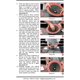 thumbnail image 5 of Kit de reparación de parlantes Simply Speakers 25cm 10W6v2-D4, 5 of 6