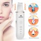 thumbnail image 3 of Espátula exfoliante facial Skin Scrubber MISERWE, color blanco, 3 of 9