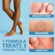 thumbnail image 4 of Crema antimicótica Curist Terbinafine 30 g 1% para hongos en los pies, 4 of 9