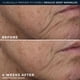 thumbnail image 5 of Crema rica en arrugas profundas Cream RoC, 50 ml, sin fragancia, 5 of 9