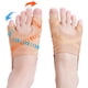 thumbnail image 1 of Corrector de Juanetes yweiuah 1 Par (talla L), 1 of 7