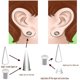 thumbnail image 2 of Kit Dilatadores de Oreja TBOSEN, 36 Piezas, Acero 316L, 2 of 3