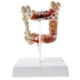 thumbnail image 1 of Escuela Modelo Patológica Del Intestino Grueso Humano 1: 2 / Exhibición De Ense?anza Médica, 1 of 3