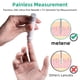 thumbnail image 4 of Lancets Metene Twist Top 30 G para dispositivos de punción, 310 unidades, 4 of 8