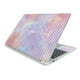 thumbnail image 1 of Skin Mighty Skins Fibra de Carbono Lenovo IdeaPad S340 15", 1 of 3