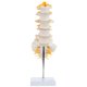 thumbnail image 1 of Modelo anatómico de columna lumbar con sacro y nervios espinales, réplica didáctica que muestra la sección lumbosacro con nervios y disco herniado en L4 - Incluye base para exhibición, 1 of 9