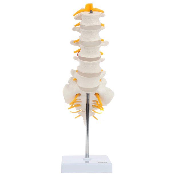 Modelo anatómico de columna lumbar con sacro y nervios espinales, réplica didáctica que muestra la sección lumbosacro con nervios y disco herniado en L4 - Incluye base para exhibición