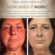 thumbnail image 4 of Herramienta de estiramiento facial 5 en 1 OMG Blaster de Ashley Black, 4 of 8