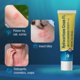thumbnail image 5 of Crema anti comezón TenderGentle Hidrocortisona al 1% 30 mL, paquete de 6, 5 of 6