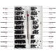 thumbnail image 2 of Kit de 500 tornillos de reparación microdiminutos con destornillador, surtido de tornillos pequeños de acero inoxidable, 18 tamaños, para gafas, portátil y joyería., 2 of 5