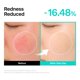 thumbnail image 5 of Crema de Alivio THOME 50 ml PDRN+Panthenol+Madecassoside, 5 of 9