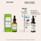 thumbnail image 2 of Aceite de rosa mosqueta Sky Organics orgánico prensado en frío 30 ml, 2 of 6