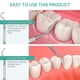 thumbnail image 3 of Raspador Dental Professional De Acero Inoxidable, 3 of 7