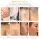 thumbnail image 3 of Serum Almond Clear Level 1, limpiador facial y corporal para acné, 30 ml, 3 of 6