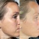 thumbnail image 3 of Sérum DIME Beauty TBT, antienvejecimiento, resveratrol y ácido mandélico, 3 of 8