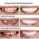 thumbnail image 2 of Carillas Dentales Genérico Naturales y Cómodas 2 Pares, 2 of 3