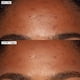 thumbnail image 4 of Sérum facial Sunday Riley Good Genes con ácido láctico todo en uno, 4 of 6
