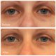 thumbnail image 2 of Sérum corrector de ojeras Murad Vita-C Eyes 15 ml, 2 of 6