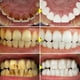 thumbnail image 3 of V34 Purple Teeth Whitening Toothpaste Remove Plaque Stains Cleaning Oral Hygiene Dental Tools Fresh Breath Beauty Health Care, 3 of 3