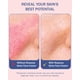 thumbnail image 5 of Sérum facial e70 Rosacea Solve con 10% de ácido azelaico, 60 ml, 5 of 9