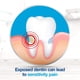 thumbnail image 2 of Pasta de dientes Sensodyne 24/7 Sensitivity Protection Extra Whitening 190 ml, 2 of 2