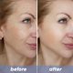 thumbnail image 4 of Suero Facial NOVIQO con Colágeno Nano-Seda Liofilizado, 4 of 7