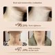thumbnail image 5 of Crema Hidratante y Reafirmante para el Cuello Venrock 50 g con Ácido Hialurónico, 5 of 8