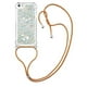 thumbnail image 3 of Funda FOXDOCK para iPhone SE con Cuerda Ajustable, Brillo Líquido, Protección Antigolpes y Lente – Ideal para Regalo, 3 of 6