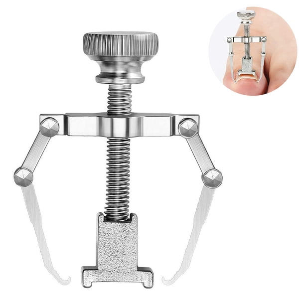 Corrector de uñas encarnadas, levantador de uñas, pedicura, cuidado de uñas de los pies, elimina el dolor y elimina el aparato ortopédico.