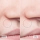 thumbnail image 4 of La filosofía de la mascarilla facial, la pureza hizo que el extractor de poros sea simple, 4 of 8