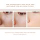 thumbnail image 5 of Gel Exfoliante Purificante Bonseor 50 g para Rostro y Cuerpo 2 Piezas, 5 of 7