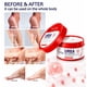 thumbnail image 4 of Crema para Pies  Urea 10%  Reparadora de Talones Agrietados y Resequedad  110g, 4 of 4