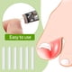 thumbnail image 3 of Tiras correctoras para uñas encarnadas (50/100 unidades), parches correctores para uñas curvadas, pinzas para enderezar y recuperar uñas encarnadas, para hombres y mujeres, cuidado de los pies., 3 of 6