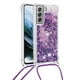 thumbnail image 2 of Funda FOXDOCK para Samsung Galaxy S21 FE con Cuerda Ajustable, Brillo Líquido, Protección Antigolpes y Lente – Ideal para Regalo, 2 of 6