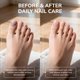 thumbnail image 5 of Barra de uñas Swissklip KlearNail Medi-Care, 10 ml, natural, 5 of 8