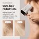 thumbnail image 3 of Nood Flasher Pro IPL Laser Hair Removal Device, Forbes Be, 3 of 3