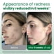 thumbnail image 2 of Toallas faciales desechables CLEAN SKIN CLUB Clean Towels® XL 50 unidades, 2 of 9