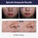 thumbnail image 2 of Ampolla TOSOWOONG Real Spicule 30.000 chupos de 30 ml con niacinamida, 2 of 6