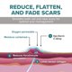 thumbnail image 4 of Gel de silicona Scar Sheets Biodermis Epiderm para cicatrices, 4 of 8