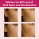 thumbnail image 4 of Crema Facial Roseblem con 7% Arbutina y Ácido Tranexámico 50 g, 4 of 9